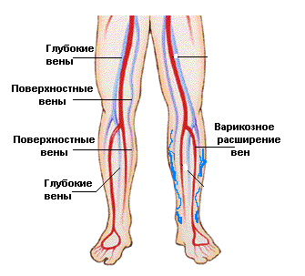 Пригодность и варикоз